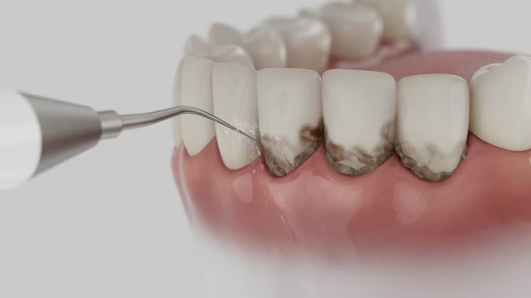 Trusted Dental Crowns And Bridges service in Roscoe, IL - Dentist Open Now
